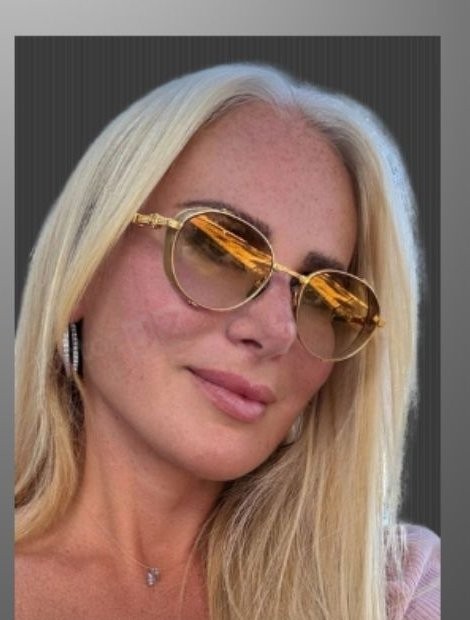 Deep plane facelift after 6 months — Dr. Zereyak Istanbul