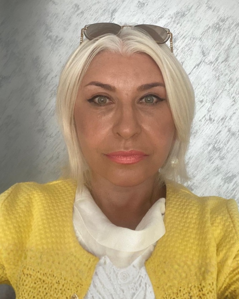 Deep plane facelift recovery at 3 months